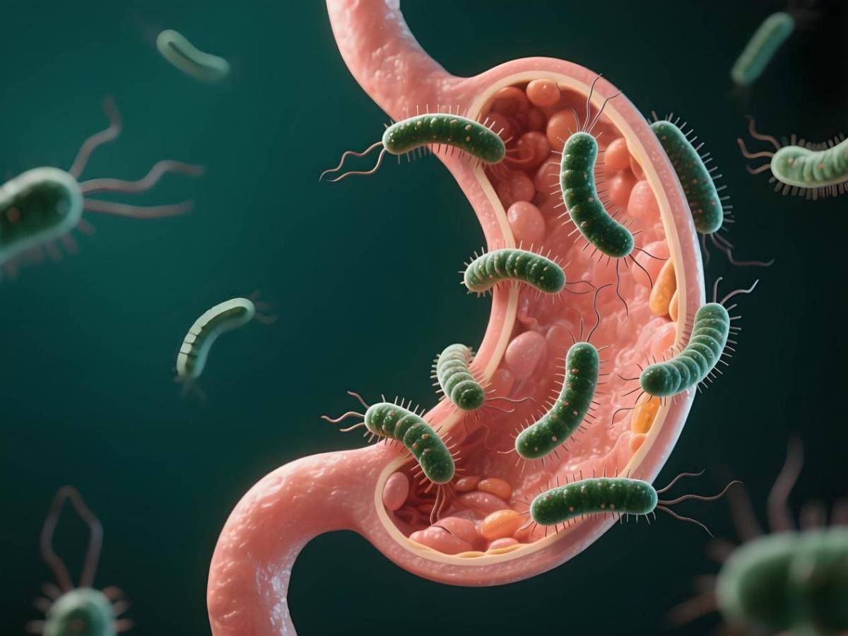 幽門螺旋菌可致癌？幽門螺旋菌症狀、傳播途徑、檢測、治療及預防方法